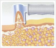 vacum_002.jpg